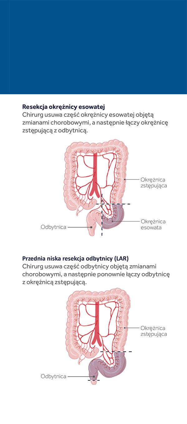 lapco-rak-jelita-grubego-03